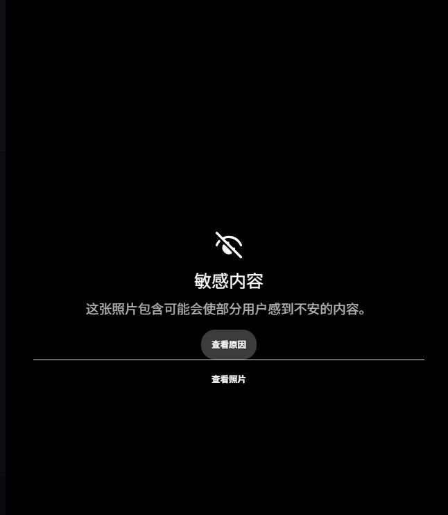 范德彪小拇指脱臼刺穿皮肤 伤情图被ESPN标记敏感